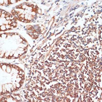 Immunohistochemistry-Paraffin: VASP [p Ser157] Antibody - Azide and BSA Free [NBP3-05448]